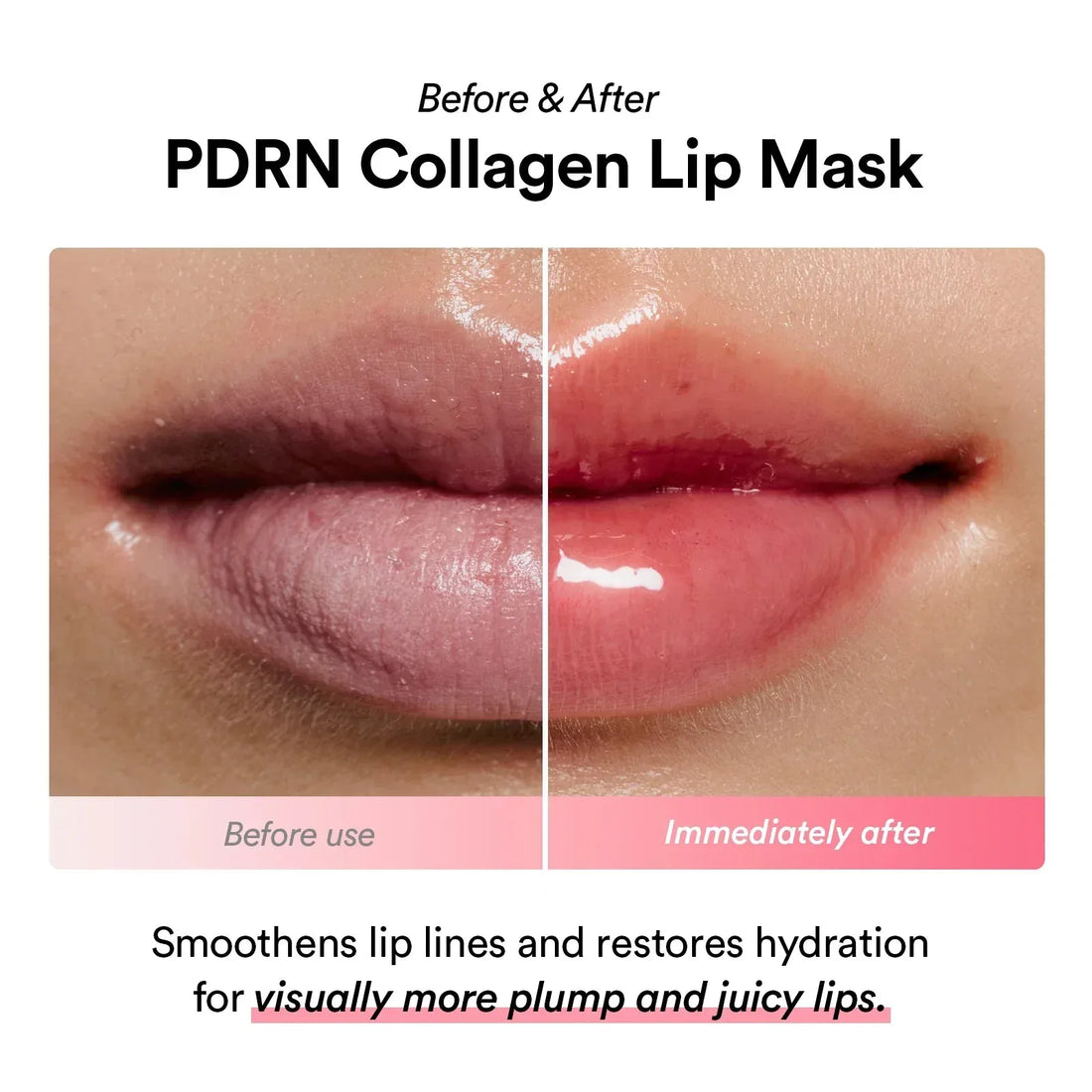 Why You Shouldn't Use Your Regular K-Beauty Products on Your Lips — And What to Use  Instead