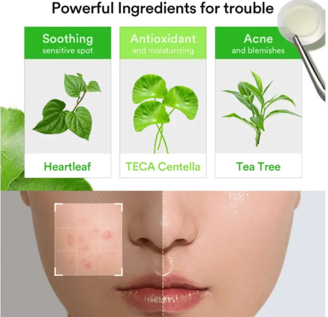 Abib Heartleaf Calming Spot Patch, 78 Patches - Seoulma-skincare