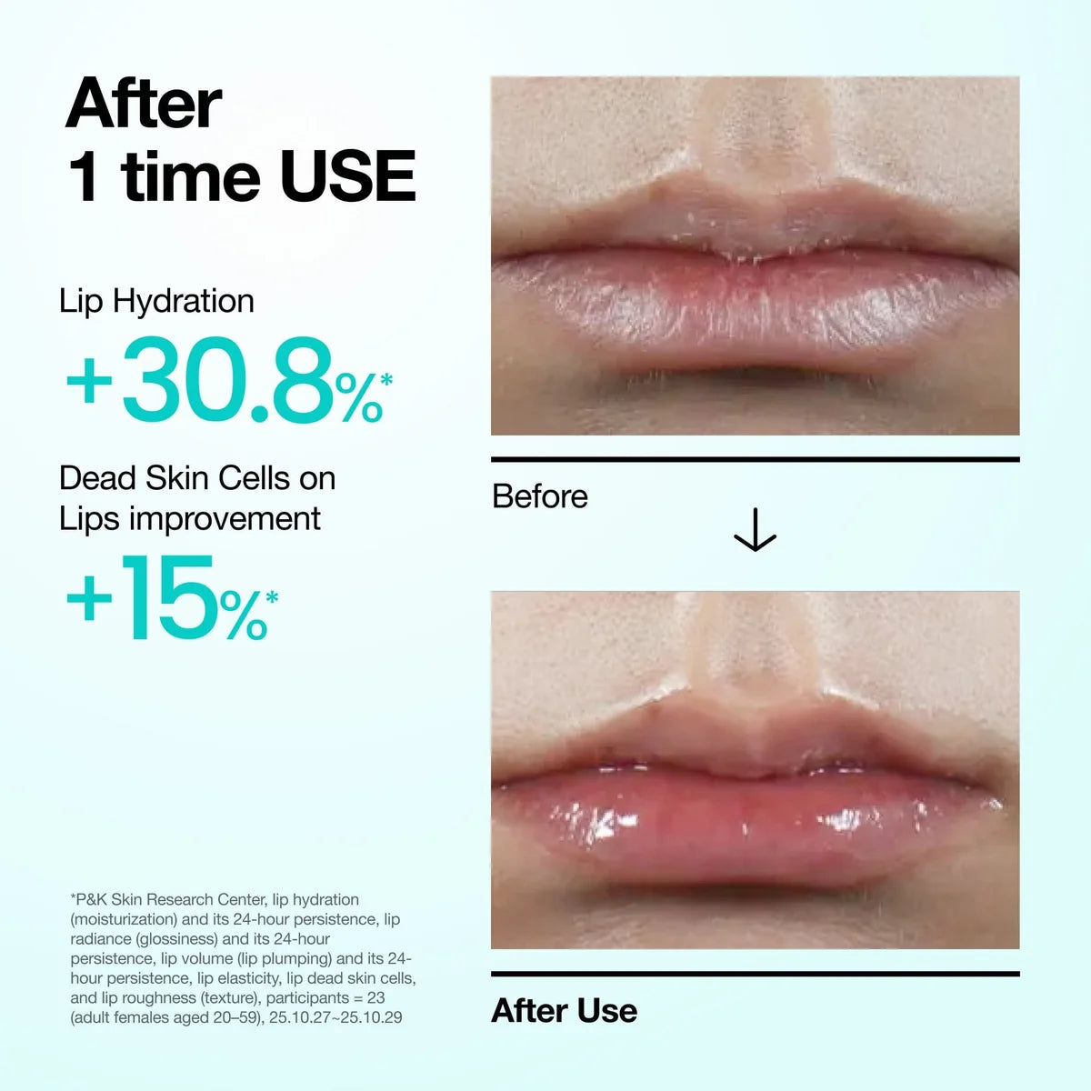 Anua PDRN Lip Serum 10 ml | Plumping Korean Lip Care