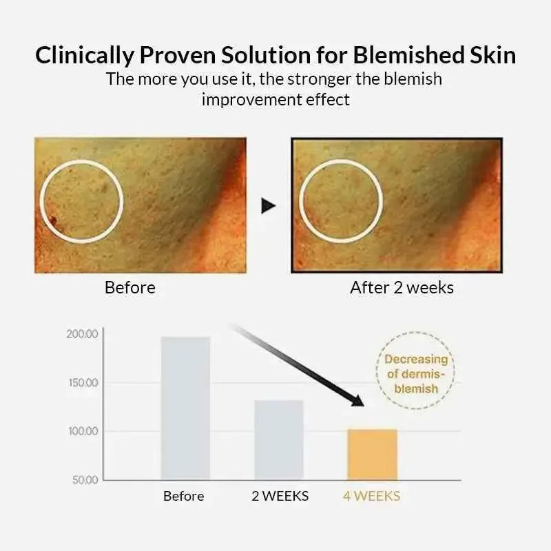 Celimax - Pore+Dark Spot Brightening Serum - Brightening Face Serum - 30ml - Seoulma-skincare