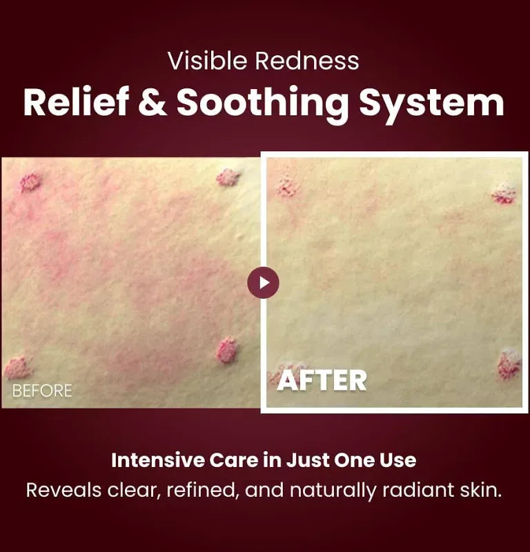 Kopher curepair Melder SOS system - Seoulma-skincare