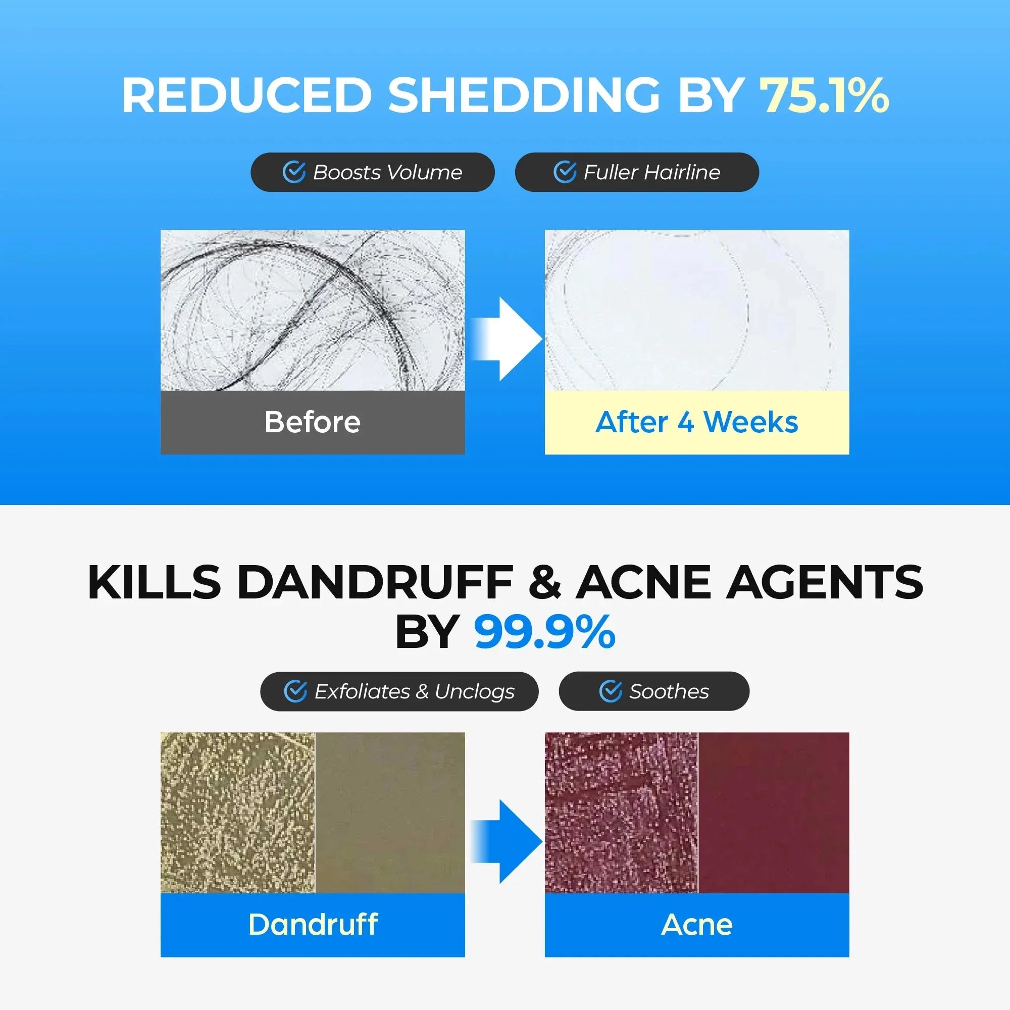 Seapuri - Scalpy Bubble Tonic - Strengthening and Exfoliating Scalp Tonic - 100ml - Seoulma-skincare